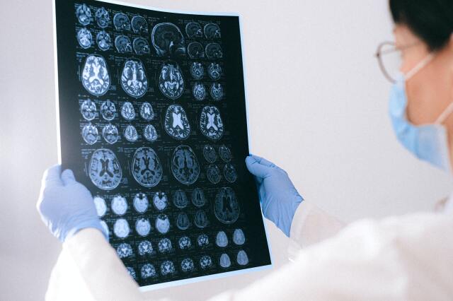 Alzheimer demansın bir türü. Demans vakalarının yüzde 60-70’ini Alzheimer hastaları oluşturuyor.