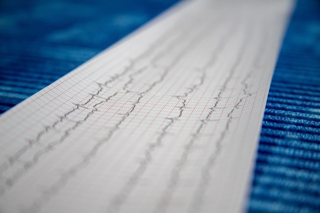 Biyo-çözülür jel fareler üzerinde yapılan EKG ölçümlerinde sınıfı geçti