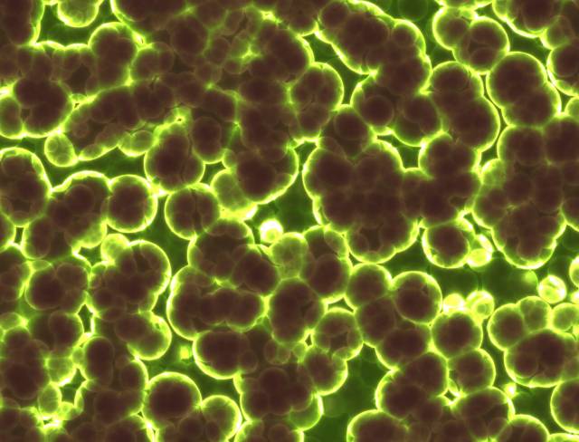 Bakteriler zamanla moleküler farklılaşmaya giderek antibiyotiklere dirençli hale gelebiliyor.