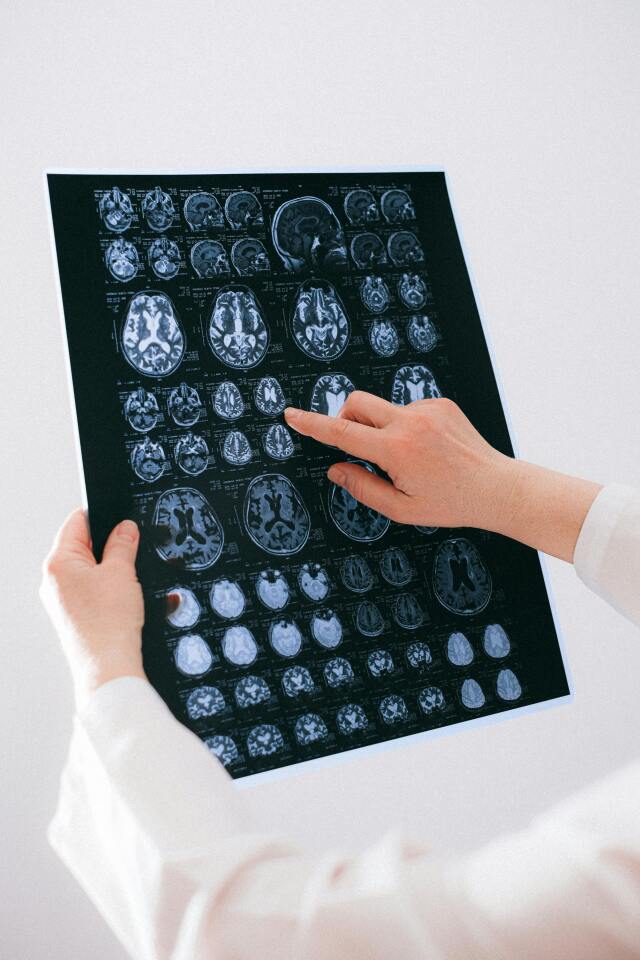 Alzheimer, Parkinson ve diğer nörolojik hastalıkların erken teşhisi, genetik ve epigenetik verilerle desteklendiğinde tedavi stratejileri geliştirilebiliyor.