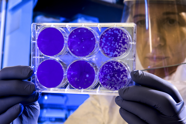 COVID-19 aşısında yararlanılan RNA genetik teknolojisi kanser başta olmak üzere birçok hastalığa karşı aşı geliştirme konusunda kullanılıyor.