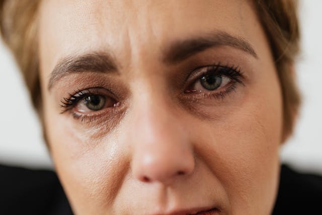 Dismorfofobisi olan kişilerde anksiyete, depresyon, yeme bozukluğu, obsesif kompulsif bozukluk ve farklı bağımlılıklar da görülebiliyor. 