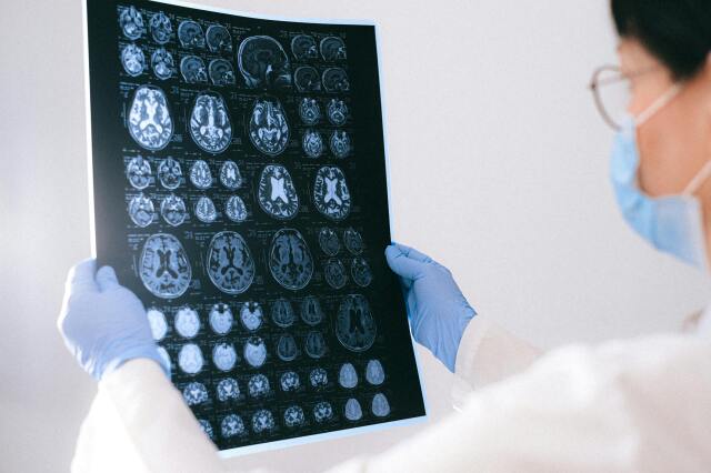 Bilim dünyası beynin sırlarını çözmeye çalışıyor. Beyin implantları, insanların zihinsel süreçlerini artırmayı, zihinsel hastalıkları tedavi etmeyi vaat ediyor.